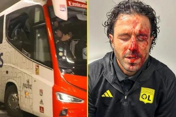 Violence Erupts as LyonFC Coach Injured, Forcing Cancellation of Highly Anticipated French Football Clash